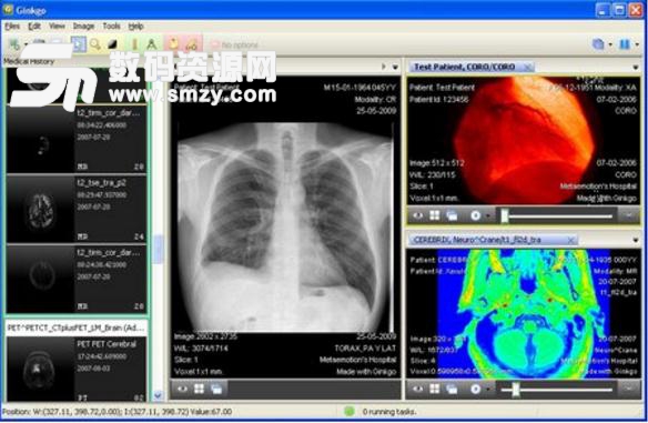 Ginkgo CADx Pro医学图像浏览官方版