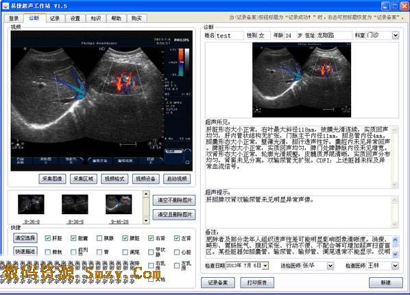 易捷超聲工作站