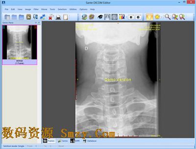 放射科DICOM編輯工具