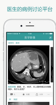 医学影像苹果版(iphone医疗软件) v1.7 IOS免费版