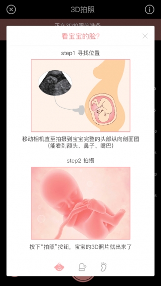 胎儿相机v1.1.6
