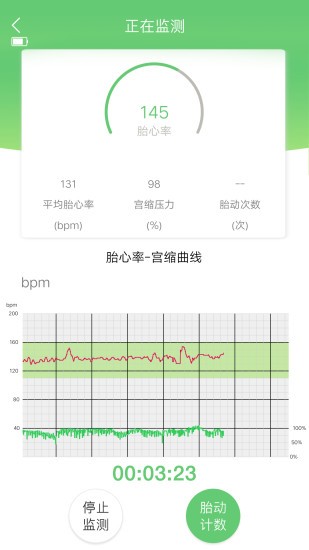 喜芽胎心監護儀軟件1.2.34