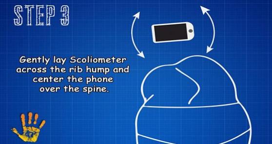 脊椎测量仪手机版界面