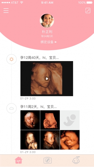 胎儿相机v1.1.6
