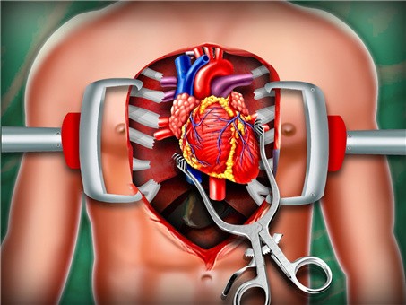 模拟心脏手术v2.6