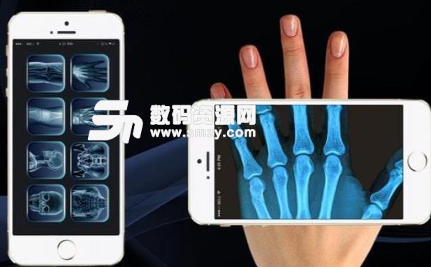 x光扫描仪2中文版