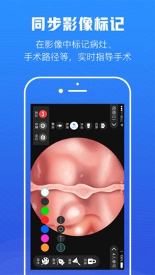 远程手术协作v1.4.8
