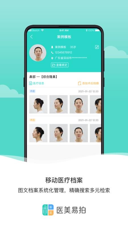 医美易拍appv2.0.2