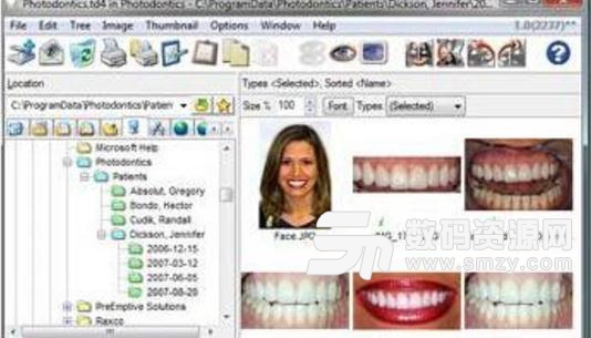 Photodontics Pro图像管理最新版