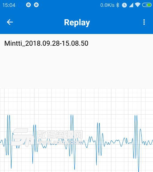 Mintti最新版(聽診器配套使用的軟件) v1.6.5 安卓版